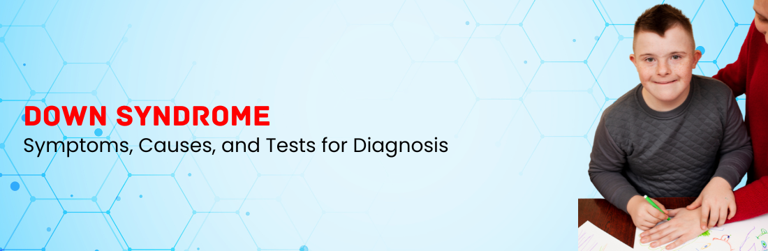 Down Syndrome: Its Symptoms, Causes, and Tests for Diagnosis